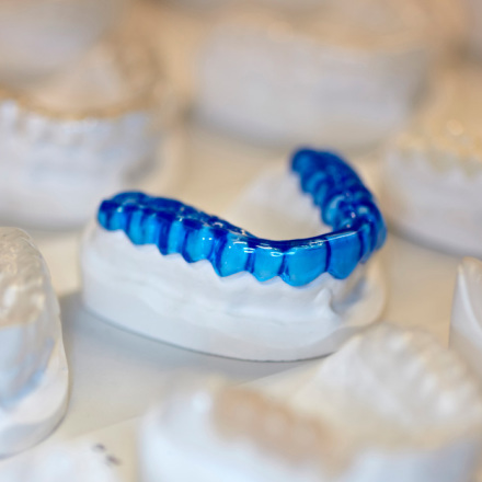 Occlusal Splints (Night Guards)